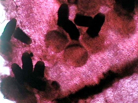 Light micrograph of soyabean epidermis peel off stained with fuchsin, showing sub-epidermal perithecia ascocarp and protruding perithecial beaks of D. phaseolorum var. caulivora (original x50).