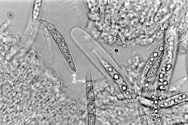Ascospores released from squashed pseudothecia of L. maculans. Scale bar = 20µm.
