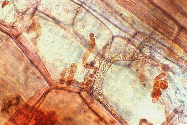 Intercellular hyphae with intracellular haustoria.