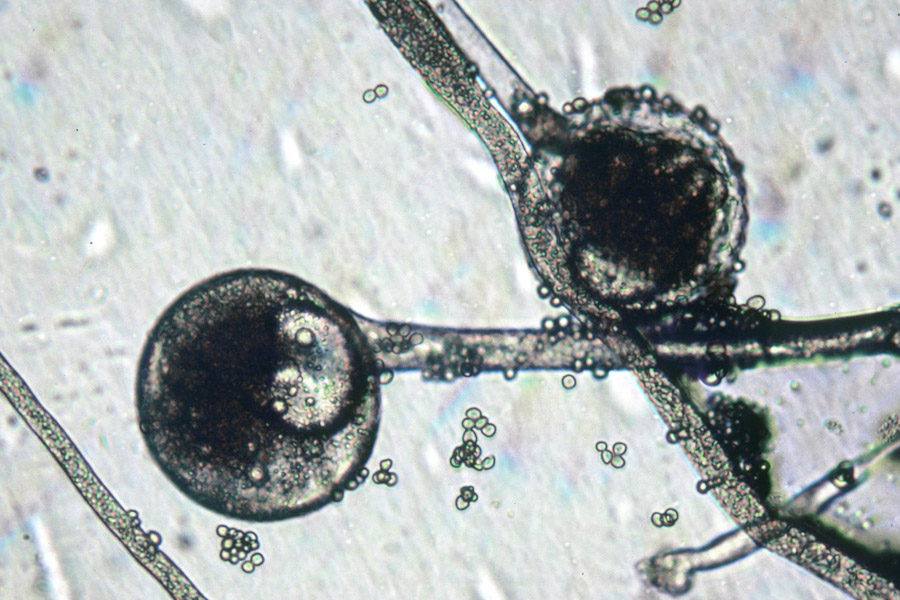 rhizopus under microscope