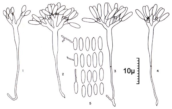 Conidia and conidiophore (note scale).