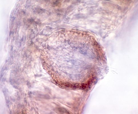 mancha foliar de septoria cannabis