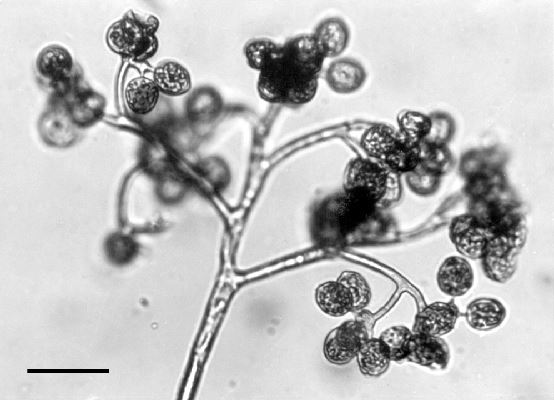 Bremia lactucae (downy mildew of lettuce); the sporangia (which do not form zoospores and therefore function as conidia) are still attached. Each is approximately 20 µm diameter.