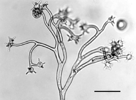 Bremia lactucae (downy mildew of lettuce); sporangia have become detached and the ends of the branches of the sporangiophore can be seen to be expanded into discs, each with 4-6 pegs around its margin. The sporangia were once attached singly to each peg.